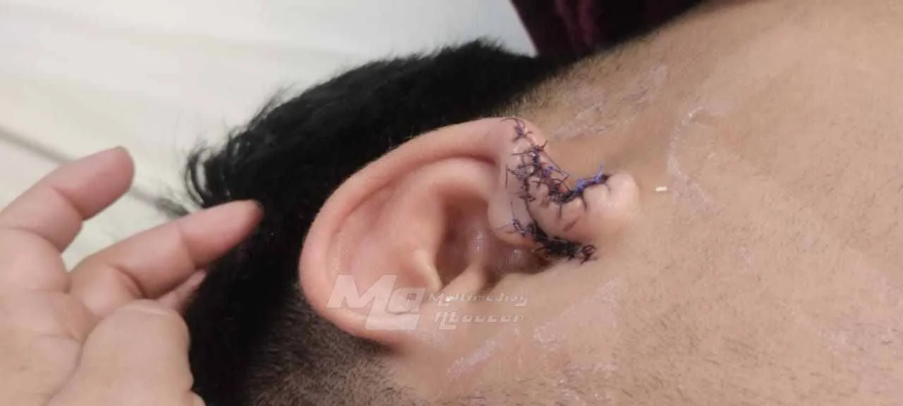 Joven Agredido en Medanitos - 01